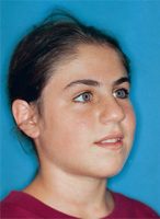 הדס-דרור-4.3.1996-ראשי